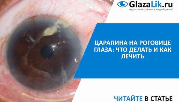 лечение царапин роговицы глаза